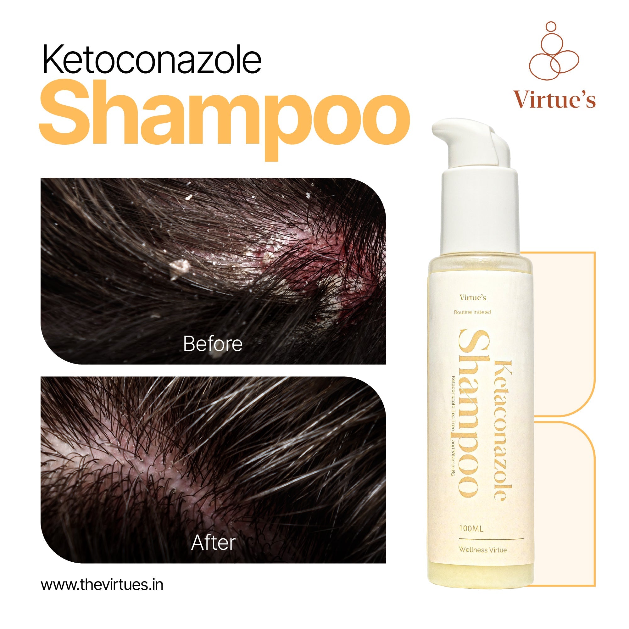 Virtue's Anti-Dandruff Shampoo with Ketoconazole & Tea Tree